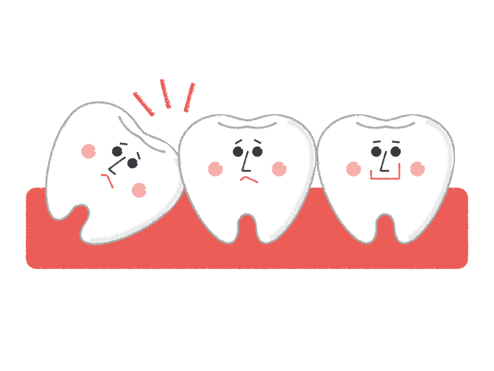 「親知らず」抜くか抜かないか、迷っていませんか？