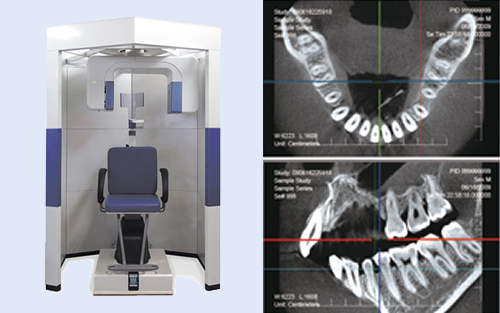 歯科用CTでの精密診断
